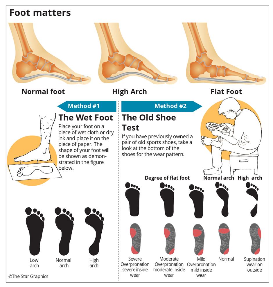 normal arch foot