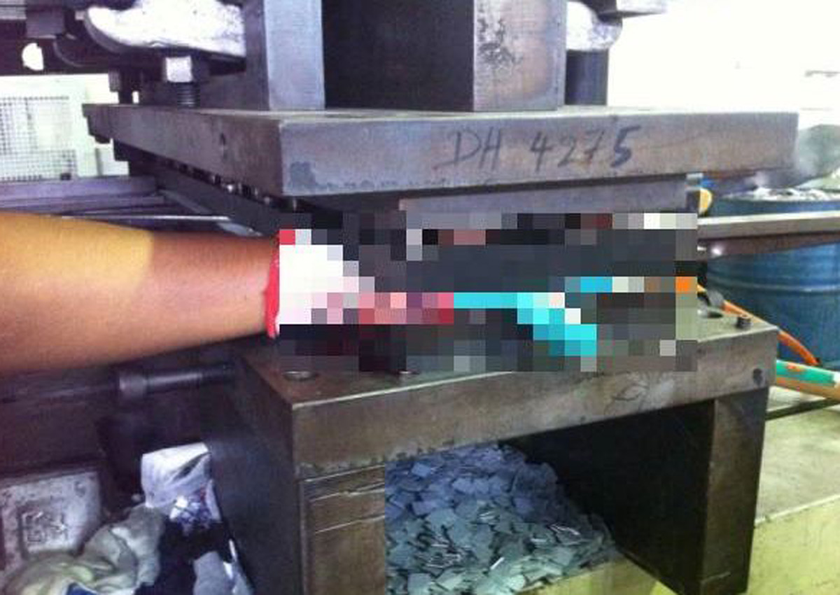 Malaysia factory worker's hand crushed in freak accident, Malaysia News