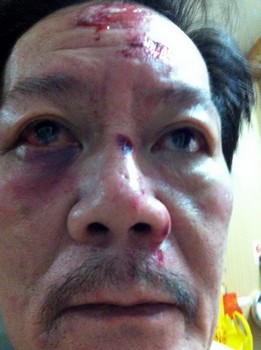 Mr Gui Hwee Meng, 58, was attacked, allegedly by a passenger, and was unable to drive to get help. - pic4