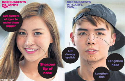 double eyelid surgery singapore blogger