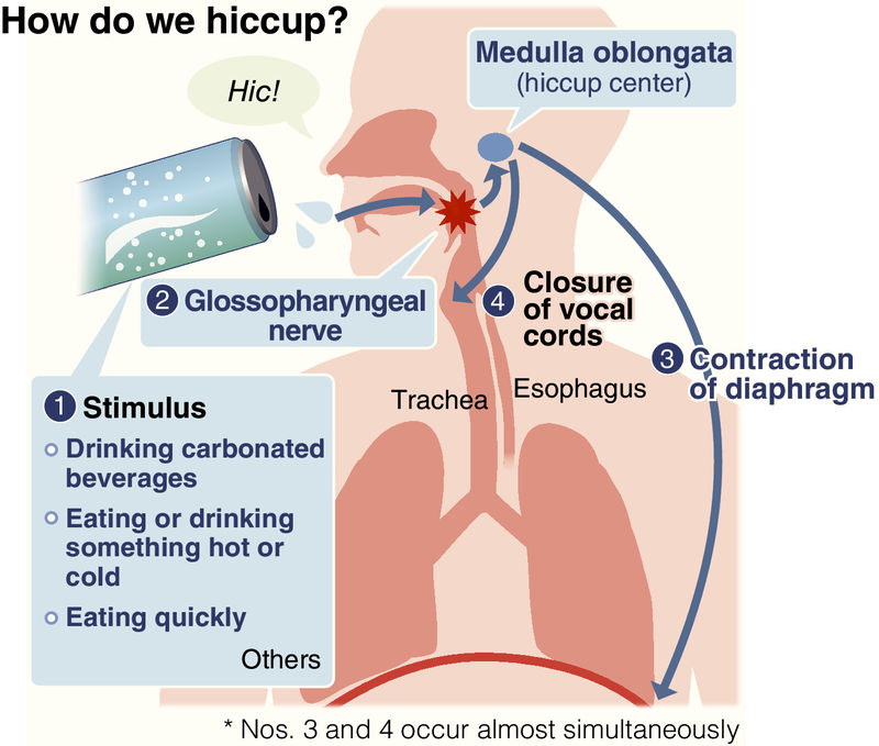 irregular heartbeat causes hiccups