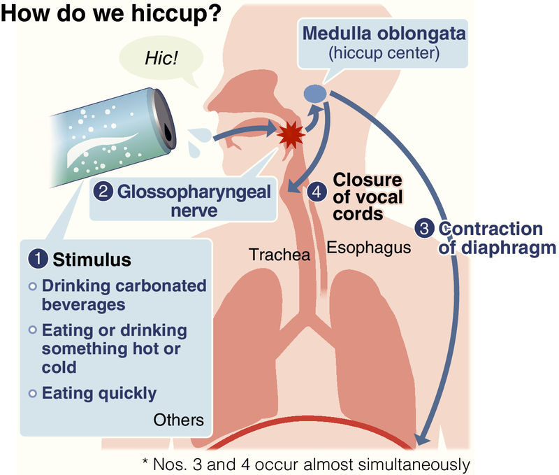 what-causes-hiccups-and-how-to-make-them-stop