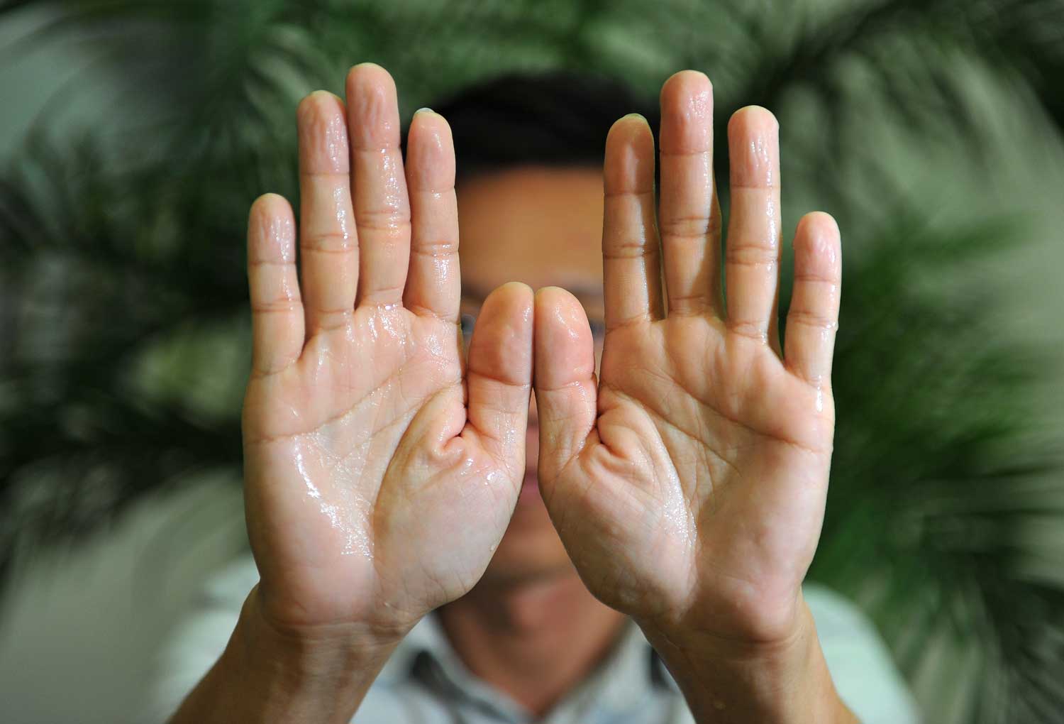 sweaty-palms-can-affect-self-esteem-health-news-asiaone