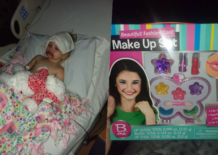 3 Yr Old Girl Suffers Severe Allergic Reaction To Kids Makeup