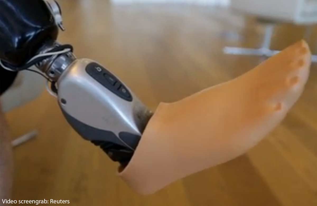 Бионический протез ноги. Ossur протезы. Биопротезирование конечностей. Bebionic протез ноги. Ossur протезы ног.