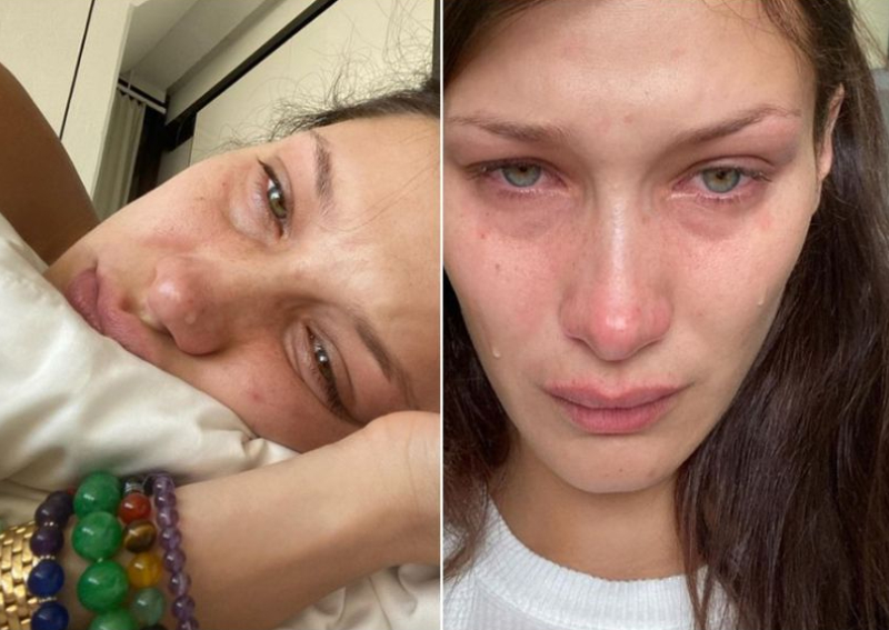 Bella Hadid posts crying photos to share mental health struggles