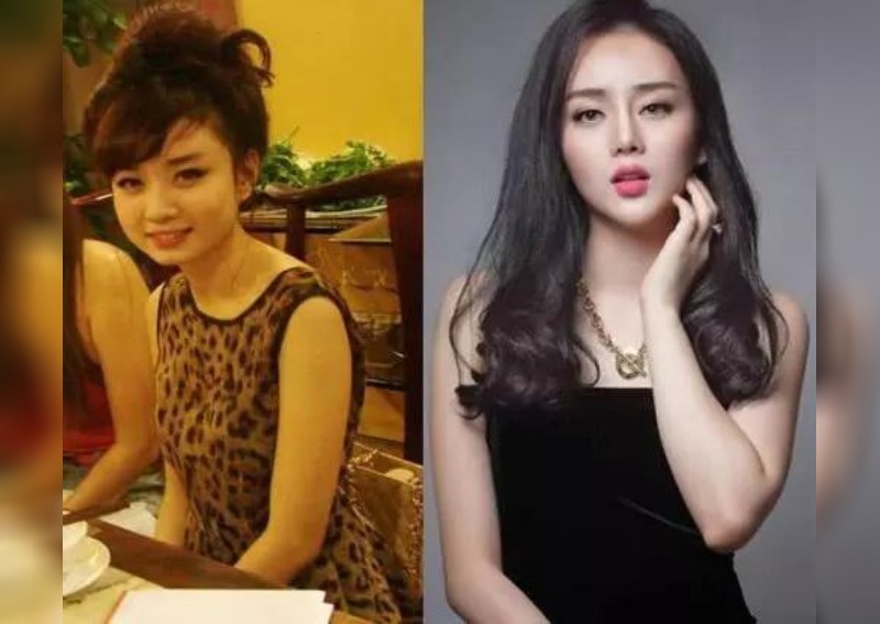 Daily Roundup Vietnamese Girl Gets Plastic Surgery To Look Like Fan Bingbing And Other Top Stories Today Asia News Asiaone