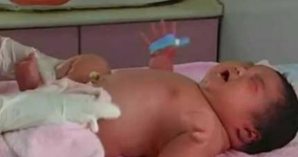 7kg Baby Boy Biggest Ever Born In China Health News Asiaone