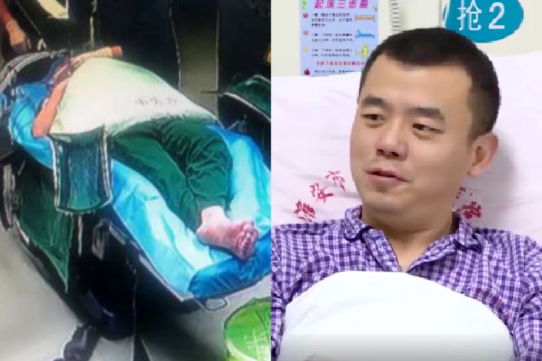 Chinese Doctor Performs Surgery While Ill Undergoes Emergency Surgery