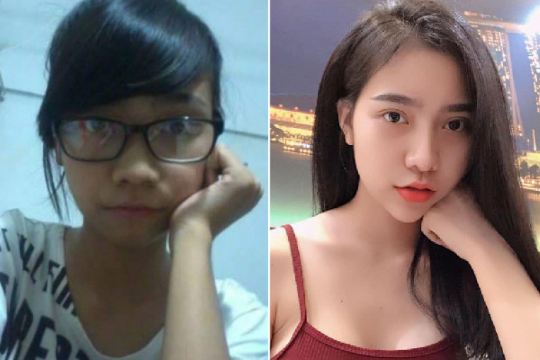 asian women plastic surgery