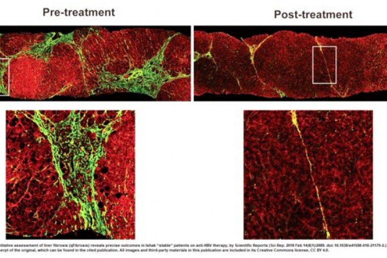 HistoIndex's AI-based Digital Pathology Platform: A Validated ...