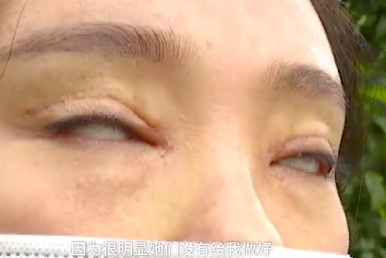 how much does double eyelid surgery cost in korea